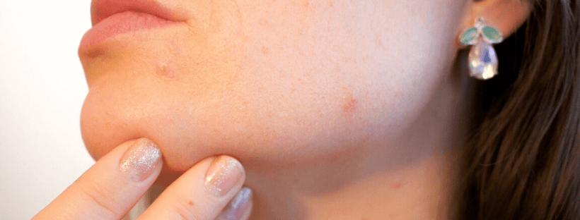 Quando troppo sole non fa bene alla pelle: qual è la sua incidenza sui tumori cutanei